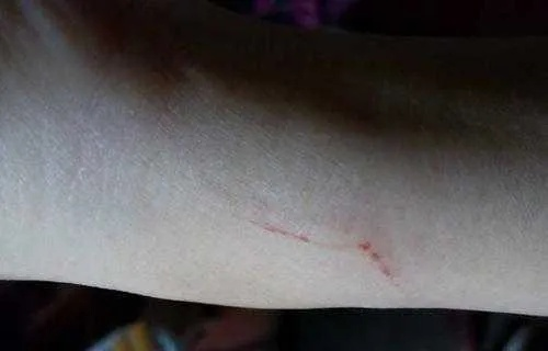 梦见猫抓伤了我，周公解梦说不好怎么办？