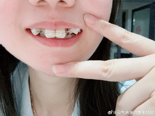 梦境解析，昨晚梦见失去三颗牙——探索虎牙与大牙的象征意义