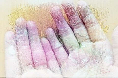 恋爱中女人梦见自己左手脱皮，象征意义与情感解析