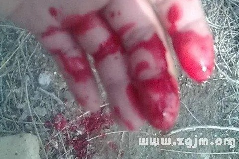 梦境解析，晚上梦见妈妈腿断了两次并大量出血