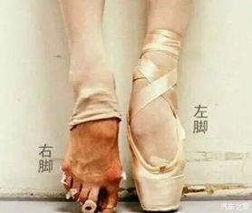 梦境解析，蝙蝠咬右小腿的深层含义与心理解析