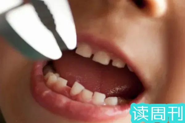 梦见掉牙，解读梦境中的三颗牙