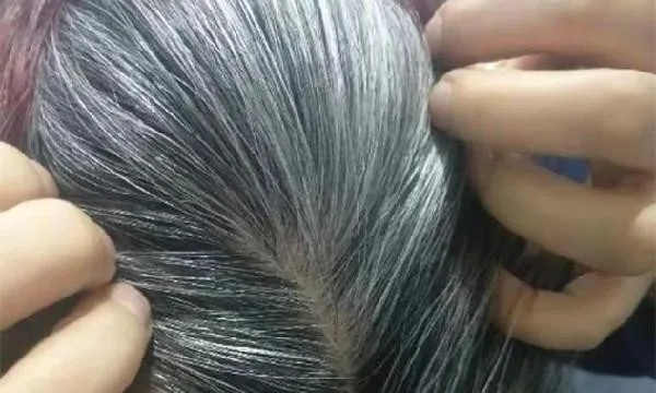 梦见自己很多白头发，探索梦境背后的深层含义与启示
