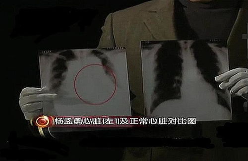 最近做梦老是梦见被人追怎么回事啊？解析梦境中的追逐与逃避