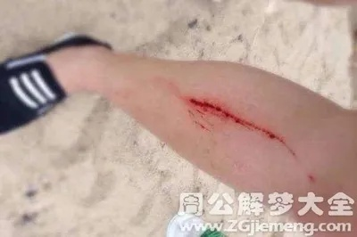 梦境解析，晚上做梦梦到自己左腿小腿往外喷血