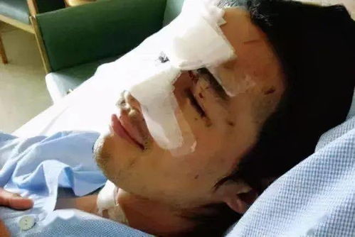 梦境奇遇，飞驰车窗外的意外之安