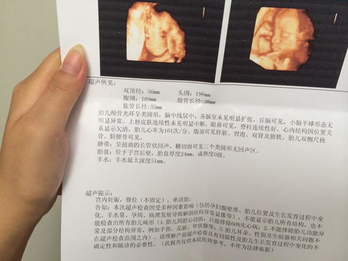 怀孕梦见活人死了准备打胎好不好，梦境背后的深层含义与心理解析