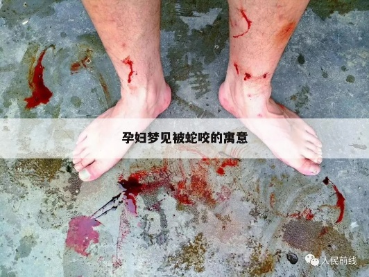 孕期梦境之谜，老公为何频繁梦见蛇咬？