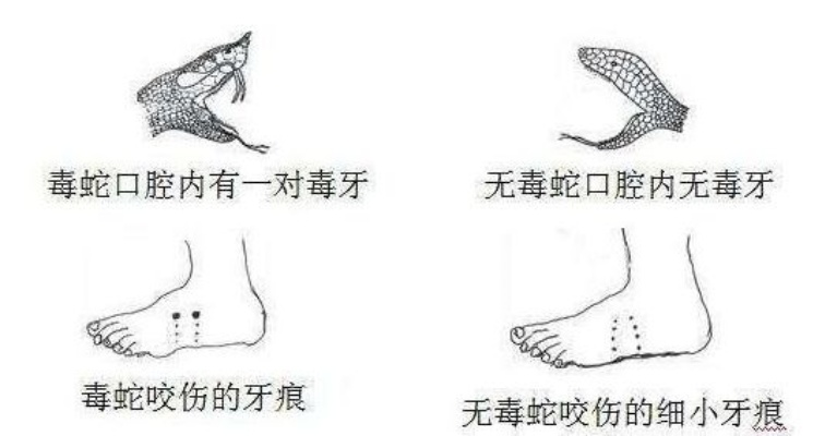 梦境解析，为何我会梦见被无毒蛇咬并尝试拔除？