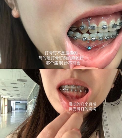 周公解梦，梦见口腔里老流血的深层含义与预兆