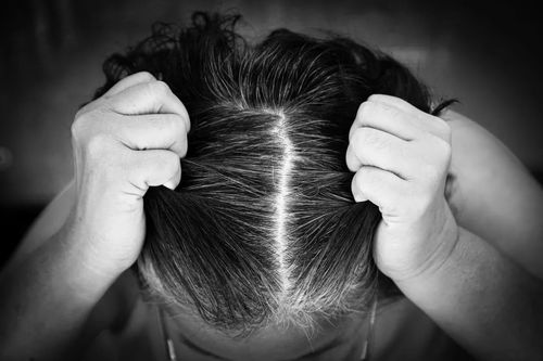 我梦到头顶头发白了，梦境背后的深层预示与心理解析