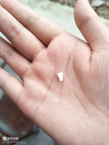 梦见自己掉了几颗牙呕吐到母亲嘴里，预兆与心理解析的深层探索