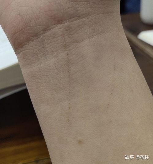 解梦，梦见手被猫抓伤