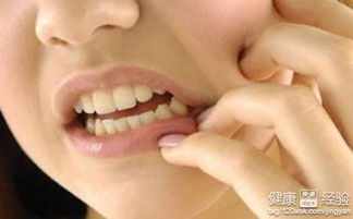 梦到自己上边的牙齿被人打掉了还流了很多鲜血，解析梦境背后的深层含义