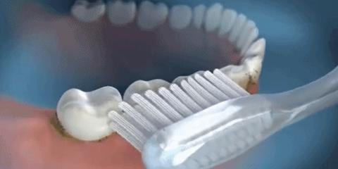 晚上梦见自己牙齿掉光，梦境背后的深层含义与解析