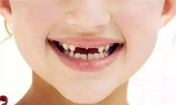 昨晚梦见一颗门牙掉了一个快掉了，解读梦境中的预兆与心理暗示