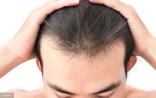梦见自己掉了上牙还流了好多血碎了几个手里拿了两个门牙没碎是，解读梦境中的自我成长与变化