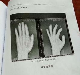 求解梦，自己受伤却未见血，寓意何在？