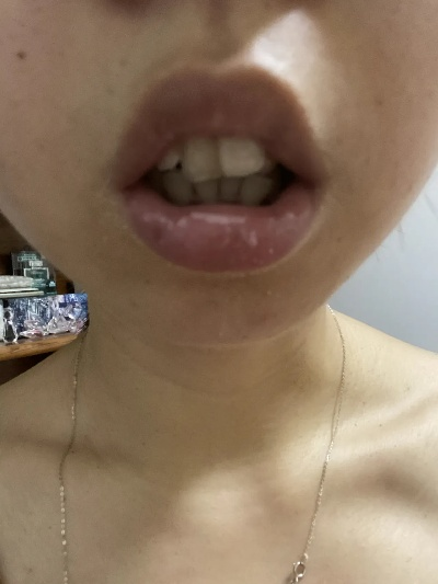 周公解梦，晚上睡觉嘴唇被老鼠咬了一下，寓意何在？