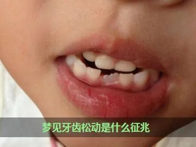 解析梦境，我总会梦见牙齿松动，该如何应对？