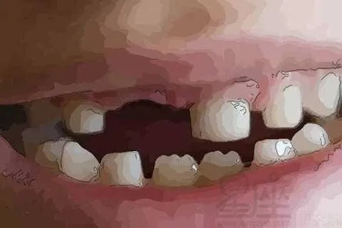梦境解析，梦见掉牙与流血的深层含义