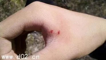 梦境解析，梦见被红色蛇咬，胳膊出血的深层含义