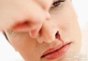 梦见鼻子流血，预示未来变化的预兆？
