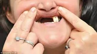 梦见右下边牙齿全掉光了，我不想让它掉，一次梦见掉那么多