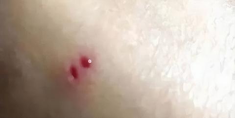 周公解梦大全，梦见很多蛇，有蛇咬了我的手，我很怕——梦境解析与心理暗示