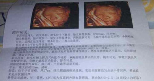 孕妇梦见什么预示生男，解读梦境中的奥秘与胎儿性别暗示