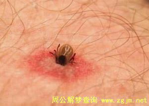 梦境解析，梦见伤口有虫子的深层含义