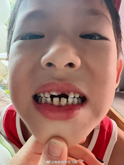 午睡梦境的启示，少一颗门牙与左前牙齿脱落的寓意，在此说破，愿各路神佛保佑