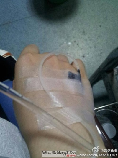 梦境解析，梦见腿上扎了好多针自己拔了好多也没血