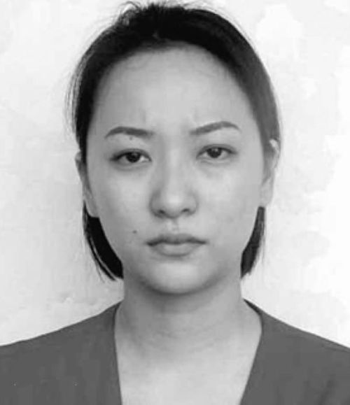 梦境预兆，女人梦到被蛇咬出血的深层含义与心理解析