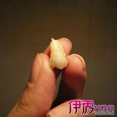 周公解梦，梦见拔大牙，预示未来变化与自我更新的象征