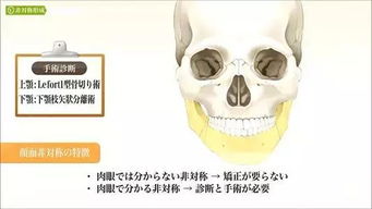 梦境的隐喻，梦见牙齿松动却未能替换的深层解析