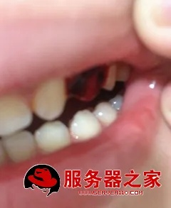 梦见自己的糙牙掉了还流了好多血，梦境背后的深层解析与心理启示