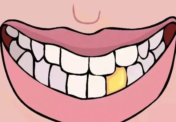 梦见牙掉，预兆吉凶的解读与心理分析