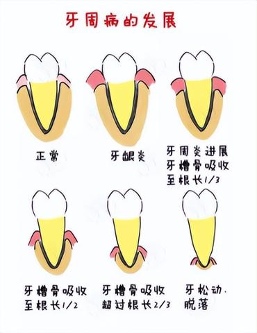 梦见牙齿掉了还流血，孕妇梦境的深层解析与心理寓意