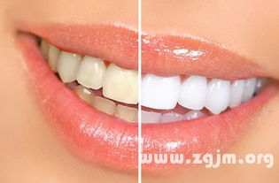 梦见头发和牙齿掉了好多，痛苦万分——梦境背后的深层含义解析