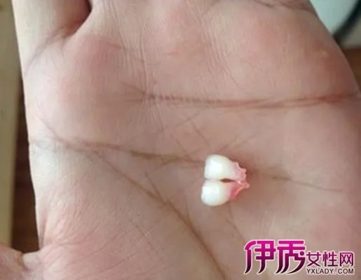 梦见自己牙掉了又长出新牙，寓意新生与转变的梦境解析
