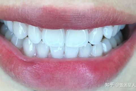 梦境中的牙落之谜，探索睡觉做梦时牙齿脱落的深层含义
