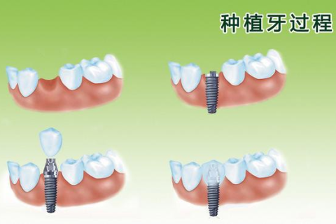 梦境解析，梦见下牙脱落与口腔出血的深层含义