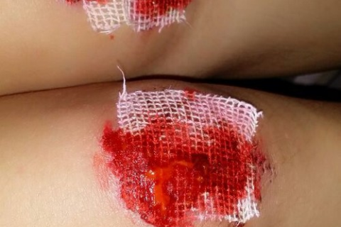 梦境中的血与泪，解析梦见自己好多兄弟受伤满身是血的深层含义