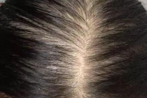 孕妇梦见掉头发，寓意与解析