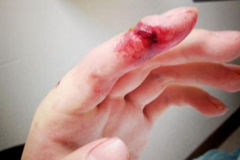 梦见被蛇咬到手指出血很多蛇，梦境背后的深层解析与心理启示