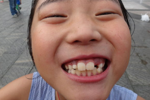 梦见自己嘴里掉了好多的牙，探索梦境背后的深层预兆与心理解析