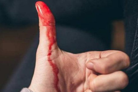 梦境解析，梦见我把别人的手砍出血，意味着什么？