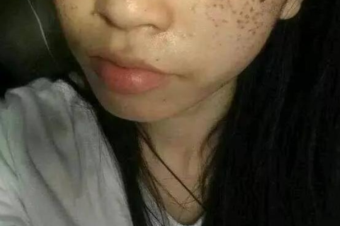 梦见一条大蛇从墙上爬出去了，探索梦境背后的深层含义