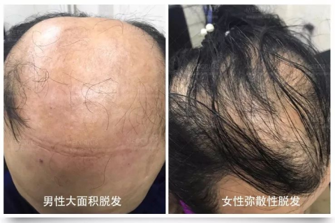 女人梦见自己下牙松动但没掉，梦境背后的深层寓意与心理解析